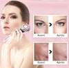 GlowLift Appareil de Soin Visage
