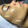 SILKYFLASH+ Dermaplaning Sonique Visage