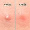 Patchs anti-boutons invisibles