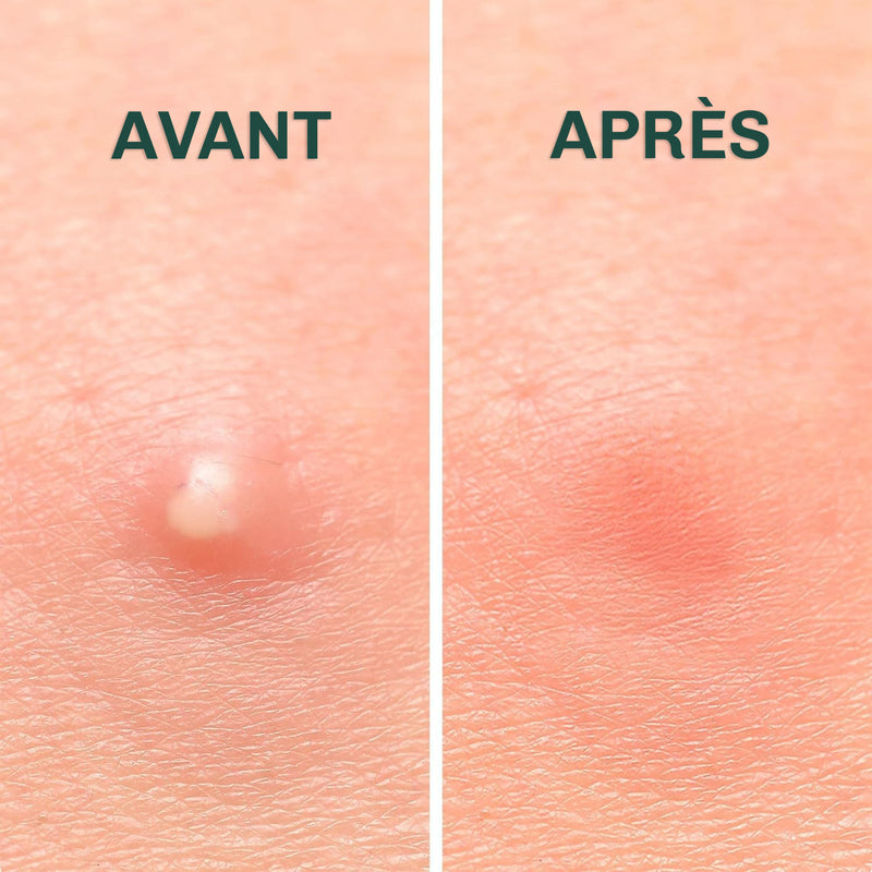 Patchs anti-boutons invisibles