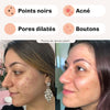 Silky Clear - Crème Anti-Points Noirs